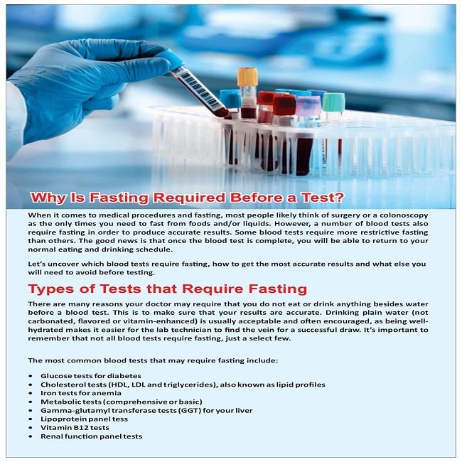 Fasting Before Blood Test