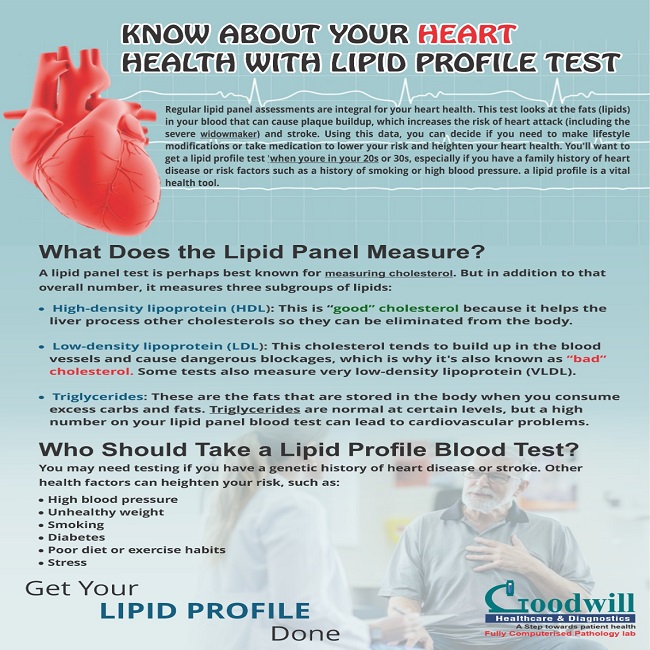 Lipid Profile Test